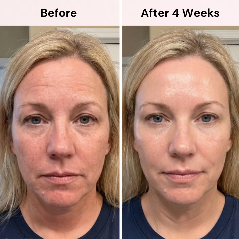 Koregene™ | PDRN Youth Revival Serum